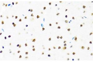 Immunohistochemistry of paraffin-embedded Mouse brain using SET Polyclonal Antibody at dilution of 1:100 (40x lens). (SET/TAF-I anticorps)