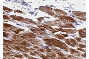 ABIN6266734 at 1/100 staining human skeletal muscle tissue sections by IHC-P. (Adenylate Kinase 1 anticorps  (Internal Region))
