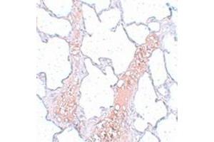 Immunohistochemical staining of rat lung tissue with REEP2 polyclonal antibody  at 5 ug/mL dilution. (REEP2 anticorps)