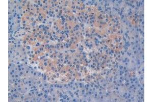 Detection of ODC in Human Pancreas Tissue using Polyclonal Antibody to Ornithine Decarboxylase (ODC)