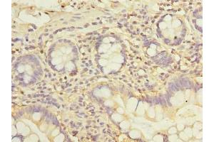 Immunohistochemistry of paraffin-embedded human small intestine tissue using ABIN7162542 at dilution of 1:100 (ZDHHC2 anticorps  (AA 230-367))