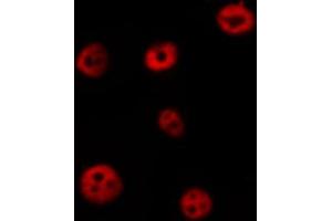 ABIN6266603 staining HeLa by IF/ICC.