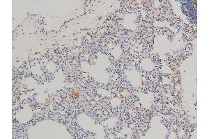 ABIN6267554 at 1/100 staining rat lung tissue sections by IHC-P.