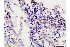 Formalin-fixed and paraffin embedded rat uterus labeled with Anti-STAT6 Polyclonal Antibody, Unconjugated (ABIN738291) at 1:200 followed by conjugation to the secondary antibody and DAB staining. (STAT6 anticorps  (AA 601-700))