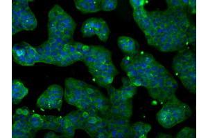 Anti-POR mouse monoclonal antibody (ABIN2453490) immunofluorescent staining of COS7 cells transiently transfected by pCMV6-ENTRY POR (RC202172). (POR anticorps)