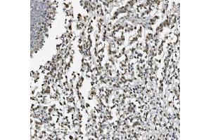 IHC analysis of METTL1 using anti-METTL1 antibody (ABIN7600484).