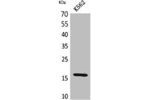 Western Blot analysis of K562 cells using CRBP II Polyclonal Antibody. (RBP2 anticorps  (Internal Region))