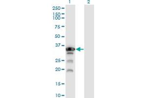 Western Blot analysis of APTX expression in transfected 293T cell line by APTX monoclonal antibody (M02), clone 2H6. (Aprataxin anticorps  (AA 69-166))
