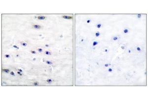 Immunohistochemistry (IHC) image for anti-Tyrosine Hydroxylase (TH) (Ser19) antibody (ABIN1847900)