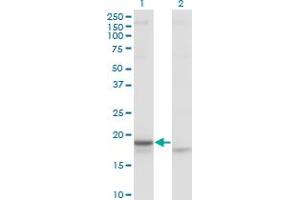 Western Blot analysis of CRH expression in transfected 293T cell line by CRH monoclonal antibody (M02), clone 2B11. (CRH anticorps  (AA 154-196))