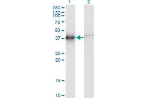 Western Blotting (WB) image for anti-Actin-Related Protein T2 (ACTRT2) (AA 209-300) antibody (ABIN599611) (ACTRT2 anticorps  (AA 209-300))