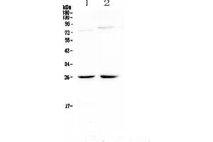 Western blot analysis of NMU using anti-NMU antibody . (Neuromedin U anticorps)