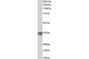 ABIN5539506 (0. (TNNT1 anticorps  (Internal Region))