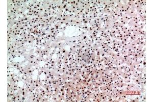 Immunohistochemistry (IHC) analysis of paraffin-embedded Human Liver, antibody was diluted at 1:100.