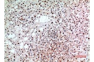 Immunohistochemistry (IHC) analysis of paraffin-embedded Human Liver, antibody was diluted at 1:100. (BCL6 anticorps  (Internal Region))