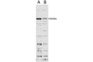 Image no. 2 for anti-SECIS Binding Protein 2 (SECISBP2) (Internal Region) antibody (ABIN374739) (SECISBP2 anticorps  (Internal Region))