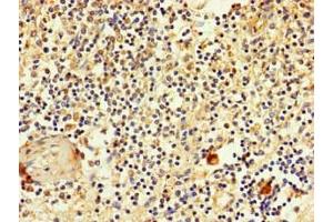 Immunohistochemistry of paraffin-embedded human spleen tissue using ABIN7170119 at dilution of 1:100