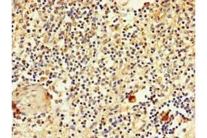 Immunohistochemistry of paraffin-embedded human spleen tissue using ABIN7170119 at dilution of 1:100 (SLC2A3 anticorps  (AA 205-269))