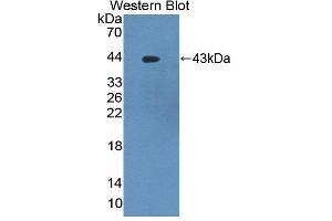 Figure. (PKC delta anticorps  (AA 330-672))