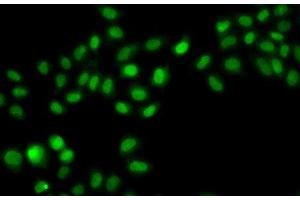 Immunofluorescence analysis of A549 cells using SULT2B1 Polyclonal Antibody (SULT2B1 anticorps)