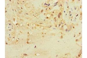 Immunohistochemistry of paraffin-embedded human placenta tissue using ABIN7171870 at dilution of 1:100 (TSPAN32 anticorps  (AA 111-202))