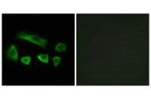 Immunofluorescence analysis of A549 cells, using NT5C1B antibody. (NT5C1B anticorps)