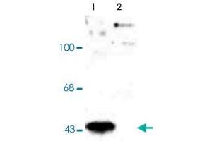 Western blot of human T-47D cells showing specific immunolabeling of the ~45k MAP2K1 (Control). (MEK1 anticorps  (pThr386))