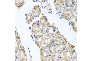 Immunohistochemistry of paraffin-embedded human stomach using GLS antibody.