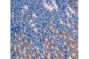 Used in DAB staining on fromalin fixed paraffin- embedded kidney tissue (ATM anticorps  (AA 486-742))
