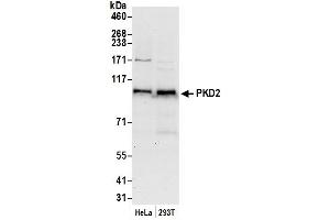 Western Blotting (WB) image for anti-Polycystic Kidney Disease 2 (Autosomal Dominant) (PKD2) (AA 320-400) antibody (ABIN7449790)