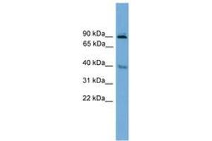 Image no. 1 for anti-L(3)mbt-Like 1 (L3MBTL1) (AA 221-270) antibody (ABIN6744661) (L3MBTL1 anticorps  (AA 221-270))
