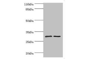 Western blot All lanes: SRPRB antibody at 2 μg/mL Lane 1: HepG2 whole cell lysate Lane 2: Hela whole cell lysate Secondary Goat polyclonal to rabbit IgG at 1/10000 dilution Predicted band size: 30 kDa Observed band size: 30 kDa (SRPRB anticorps  (AA 58-271))