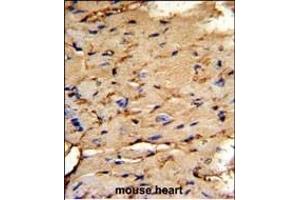 Formalin-fixed and paraffin-embedded mouse heart tissue reacted with PEA-15 Antibody (C-term), which was peroxidase-conjugated to the secondary antibody, followed by DAB staining.