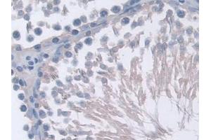 Detection of PPP2R4 in Rat Testis Tissue using Polyclonal Antibody to Protein Phosphatase 2A Activator, Regulatory Subunit 4 (PPP2R4)