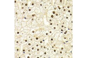 Immunohistochemistry of paraffin-embedded human liver injury using DDB1 Antibody. (DDB1 anticorps)