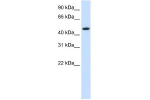 WB Suggested Anti-HSP90B1 Antibody Titration:  1. (GRP94 anticorps  (N-Term))