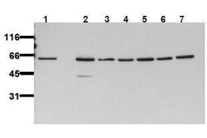 Western Blotting (WB) image for anti-V-Akt Murine Thymoma Viral Oncogene Homolog 2 (AKT2) antibody (ABIN126856) (AKT2 anticorps)