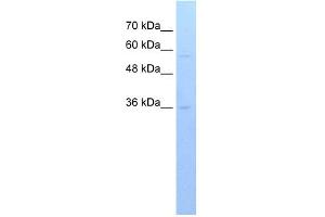 WB Suggested Anti-RFPL3 Antibody Titration:  0. (RFPL3 anticorps  (C-Term))