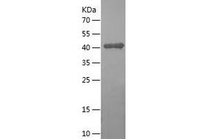 Western Blotting (WB) image for Glutamic-Oxaloacetic Transaminase 1, Soluble (Aspartate Aminotransferase 1) (GOT1) (AA 2-413) protein (His tag) (ABIN7123118)