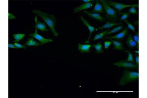 Immunofluorescence of purified MaxPab antibody to SNRPB on HeLa cell. (SNRPB anticorps  (AA 1-240))