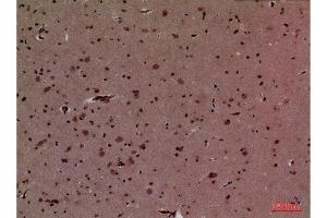 Immunohistochemistry (IHC) analysis of paraffin-embedded Mouse Brain, antibody was diluted at 1:100.