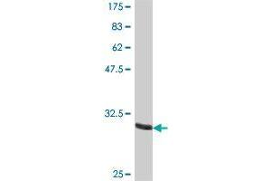 Western Blot detection against Immunogen (32.