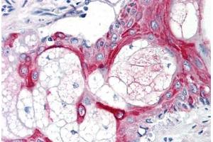 Human Skin, Pilosebaceous Unit (formalin-fixed, paraffin-embedded) stained with CD55 antibody ABIN291344 at 10 ug/ml followed by biotinylated anti-mouse IgG secondary antibody ABIN481714, alkaline phosphatase-streptavidin and chromogen.