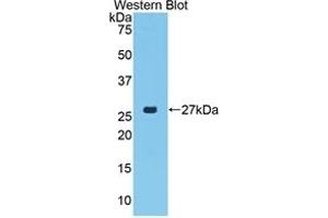 Detection of Recombinant CTGF, Porcine using Polyclonal Antibody to Connective Tissue Growth Factor (CTGF)