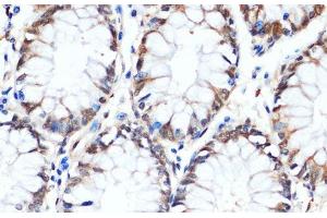 Immunohistochemistry of paraffin-embedded Human colon using HSPA1A Monoclonal Antibody at dilution of 1:100 (40x lens).