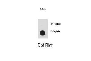 Dot blot analysis of anti-Phospho-YES1-/Phospho-SRC- Antibody (ABIN389661 and ABIN2850452) on nitrocellulose membrane. (YES1/SRC (pTyr530) anticorps)