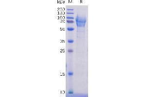 Human CD162 Protein, His Tag on SDS-PAGE under reducing condition.