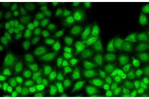 Immunofluorescence analysis of HeLa cells using JUNB Polyclonal Antibody (JunB anticorps)