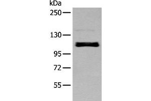 Western blot analysis of A549 cell using ZNF281 Polyclonal Antibody at dilution of 1:250 (ZNF281 anticorps)