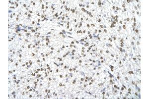 Rabbit Anti-SSB Antibody       Paraffin Embedded Tissue:  Human cardiac cell   Cellular Data:  Epithelial cells of renal tubule  Antibody Concentration:   4.